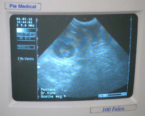 M-Wurf DW von der Huht Ultraschallbilder