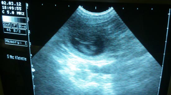 M-Wurf DW von der Huht Ultraschallbilder